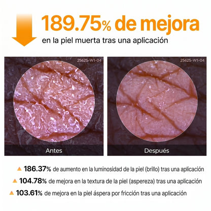 Spray esfoliante con acido cogico e curcuma - GOLDEN PEEL™